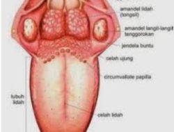 Senam Lidah Mencegah Alzeimer dan Mengetahui Mejala Stroke